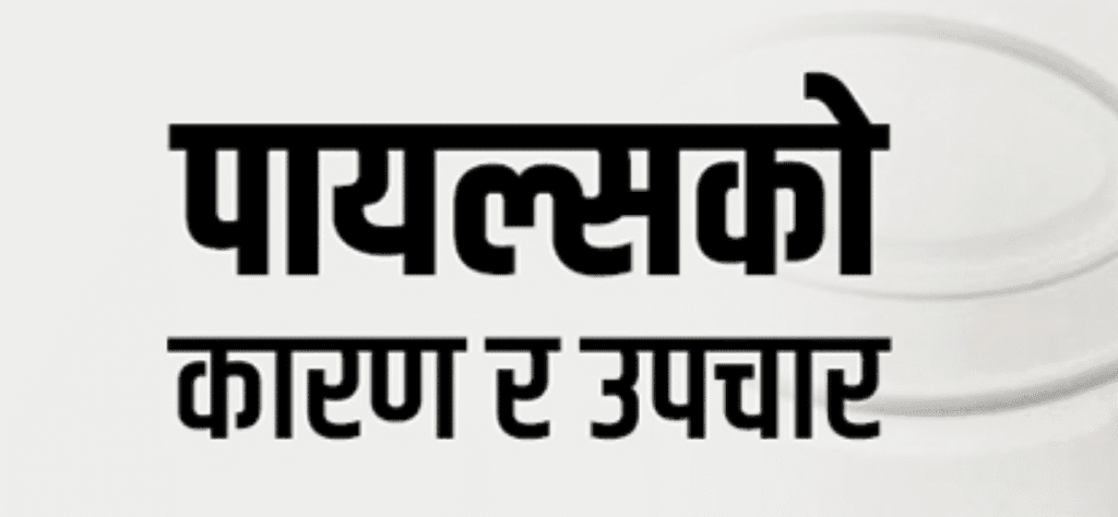 पाइल्स उपचार नेपालमा : लक्षण, कारणहरू, सावधानी र समाधान