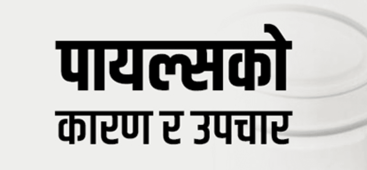 पाइल्स उपचार नेपाल: लक्षण, कारणहरू, सावधानी र समाधान