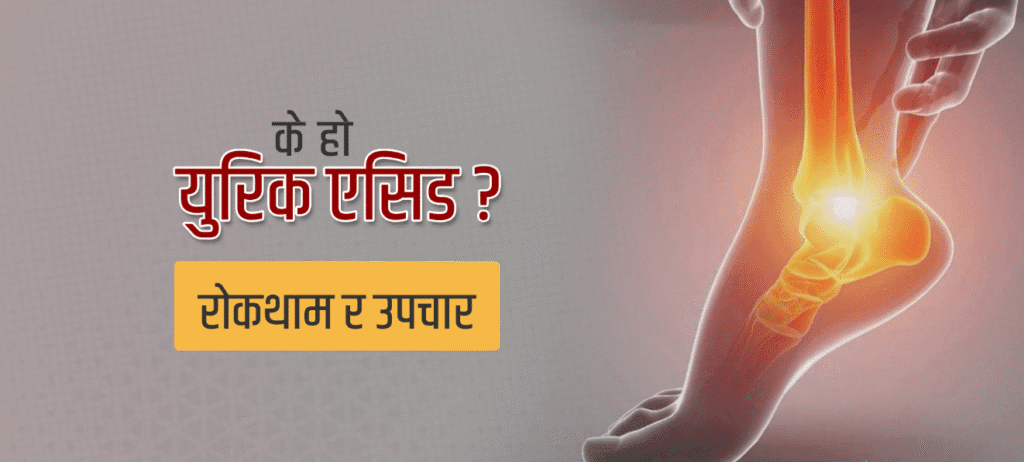 युरिक एसिड घरेलु उपचार: कारण, लक्षण र खानपान सुझाव